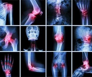 Rheumatology-SM